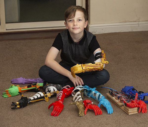 感動(dòng)！英父親為無(wú)臂兒子3D打印9只個(gè)性仿生臂(圖1)