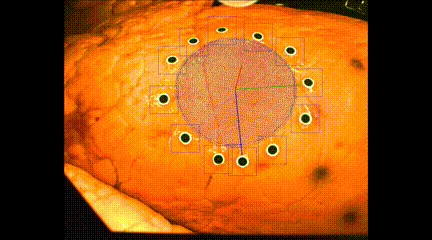 3D打印新成果!新技術(shù)或?qū)⒅υ\斷監(jiān)測(cè)新冠肺炎(圖2)